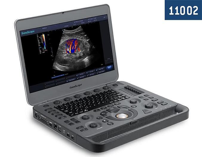 ECHOGRAPHE PORTABLE SONOSCAPE X3 EXP AVEC 2 SONDES CONVEXE ET LINEAIRE  ET SAC TRANSPORT