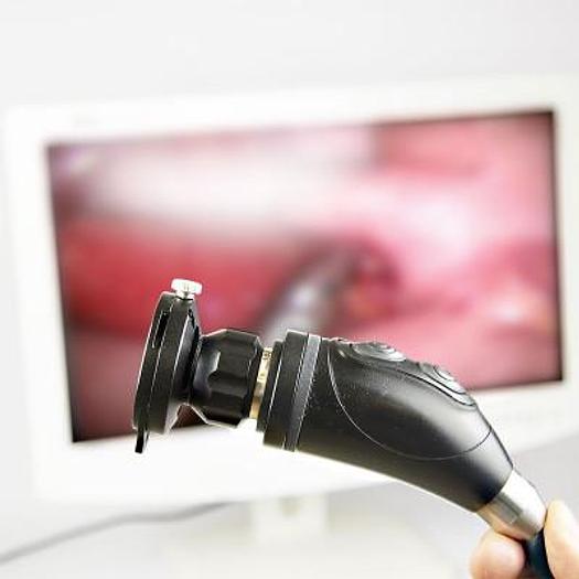 CAMERA HD ULTRA COMPACTE DE CŒLIOSCOPIE PROCESSEUR INTÉGRÉ