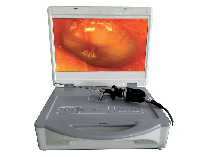 UNITÉ D’ENDOSCOPIE COMPACTE ET PORTABLE