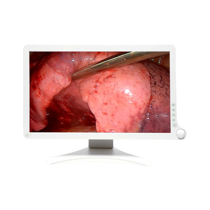 Écran chirurgical AMM 215WTD