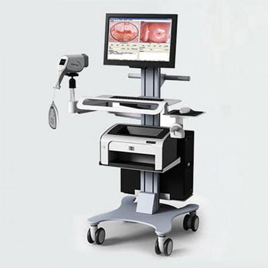 VIDÉO COLPOSCOPE TOVAMED GYSCOPE
