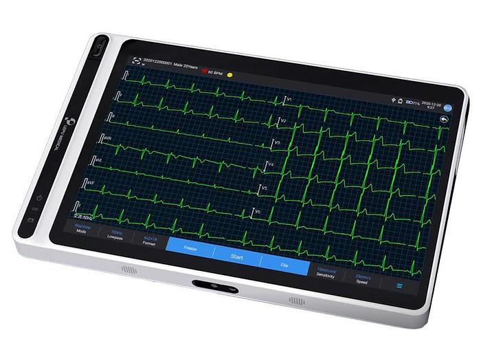 NEO ECG S120 TABLETTE ECG - CONNECTEUR BANANE