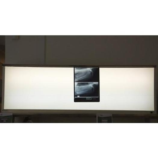 NEGATOSCOPE MULTIPLAGES 42x147 CM