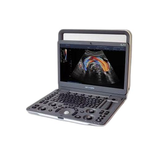 ECHOCARDIOGRAPHE PORTABLE SONOSCAPE EXPERT E2 AVEC SONDE CARDIAQUE