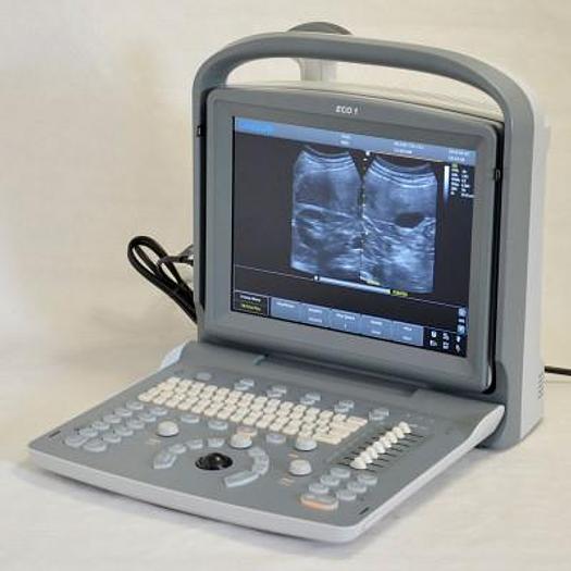 ECHOGRAPHE PORTABLE CHISON ECO1 AVEC SONDE ABDOMINALE