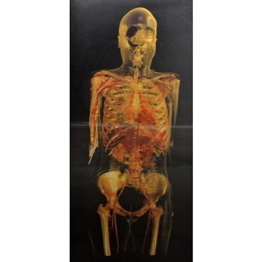 TABLEAU HOLOGRAPHIQUE REPRÉSENTANT L'APPAREIL RESPIRATOIRE ET LA CIRCULATION